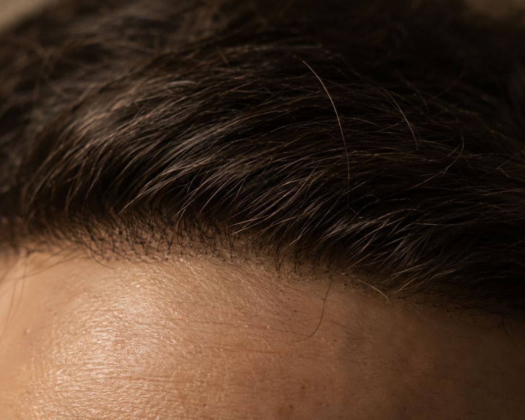 Macro of a hair system's front edge meeting skin, individual hairs emerging from an invisible lace edge.